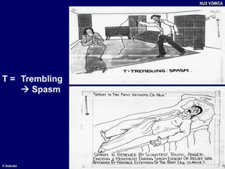 T = Trembling
 Spasm
NUX VOMICA
© Subrata
 