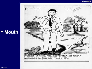 • Mouth
NUX VOMICA
© Subrata
 