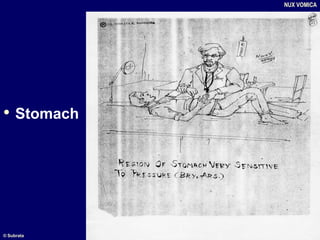 • Stomach
NUX VOMICA
© Subrata
 