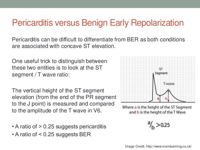 EKG Of The Month April 2017