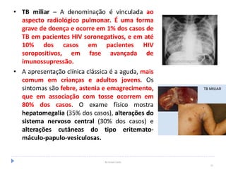 • TB miliar – A denominação é vinculada ao
aspecto radiológico pulmonar. É uma forma
grave de doença e ocorre em 1% dos casos de
TB em pacientes HIV soronegativos, e em até
10% dos casos em pacientes HIV
soropositivos, em fase avançada de
imunossupressão.
• A apresentação clínica clássica é a aguda, mais
comum em crianças e adultos jovens. Os
sintomas são febre, astenia e emagrecimento,
que em associação com tosse ocorrem em
80% dos casos. O exame físico mostra
hepatomegalia (35% dos casos), alterações do
sistema nervoso central (30% dos casos) e
alterações cutâneas do tipo eritemato-
máculo-papulo-vesiculosas.
By Ismael Costa
21
 