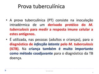 Prova tuberculínica
• A prova tuberculínica (PT) consiste na inoculação
intradérmica de um derivado protéico do M.
tuberculosis para medir a resposta imune celular a
estes antígenos.
• É utilizada, nas pessoas (adultos e crianças), para o
diagnóstico de infecção latente pelo M. tuberculosis
(ILTB). Na criança também é muito importante
como método coadjuvante para o diagnóstico da TB
doença.
By Ismael Costa
32
 