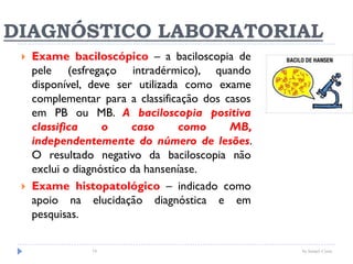 DIAGNÓSTICO LABORATORIAL
 Exame baciloscópico – a baciloscopia de
pele (esfregaço intradérmico), quando
disponível, deve ser utilizada como exame
complementar para a classificação dos casos
em PB ou MB. A baciloscopia positiva
classifica o caso como MB,
independentemente do número de lesões.
O resultado negativo da baciloscopia não
exclui o diagnóstico da hanseníase.
 Exame histopatológico – indicado como
apoio na elucidação diagnóstica e em
pesquisas.
by Ismael Costa74
 