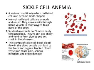 SICKLE CELL ANEMIA
 A serious condition in which red blood
cells can become sickle-shaped
 Normal red blood cells are smooth
and round. They move easily through
blood vessels to carry oxygen to all
parts of the body.
 Sickle-shaped cells don’t move easily
through blood. They’re stiff and sticky
and tend to form clumps and get
stuck in blood vessels.
 The clumps of sickle cell block blood
flow in the blood vessels that lead to
the limbs and organs. Blocked blood
vessel can cause pain, serious
infection, and organ damage.
 