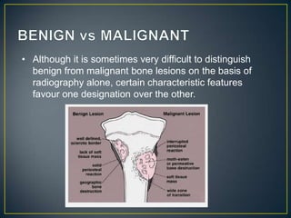 • Although it is sometimes very difficult to distinguish
benign from malignant bone lesions on the basis of
radiography alone, certain characteristic features
favour one designation over the other.

 