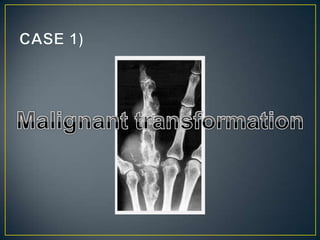 Aproach to bone   tumours