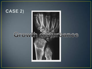 Aproach to bone   tumours