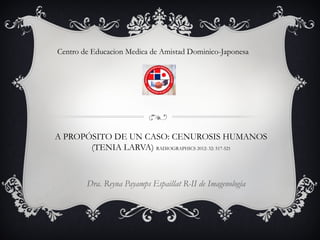 A PROPÓSITO DE UN CASO: CENUROSIS HUMANOS
(TENIA LARVA) RADIOGRAPHICS 2012: 32: 517-521
Dra. Reyna Payamps Espaillat R-II de Imagenologia
Centro de Educacion Medica de Amistad Dominico-Japonesa
 
