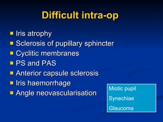 Difficult intra-op  Iris atrophy Sclerosis of pupillary sphincter Cyclitic membranes PS and PAS Anterior capsule sclerosis Iris haemorrhage Angle neovascularisation  Miotic pupil Synechiae Glaucoma 