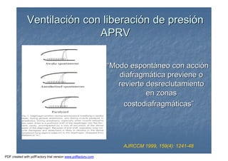 VentilaciVentilacióón con liberacin con liberacióón de presin de presióónn
APRVAPRV
AJRCCM 1999, 159(4): 1241-48
““Modo espontModo espontááneo con accineo con accióónn
diafragmdiafragmáática previene otica previene o
revierte desreclutamientorevierte desreclutamiento
en zonasen zonas
costodiafragmcostodiafragmááticasticas””
PDF created with pdfFactory trial version www.pdffactory.com
 