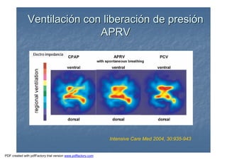 VentilaciVentilacióón con liberacin con liberacióón de presin de presióónn
APRVAPRV
Intensive Care Med 2004, 30:935-943
Electro impedancia
PDF created with pdfFactory trial version www.pdffactory.com
 
