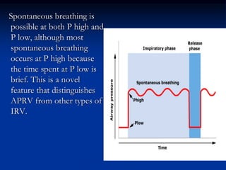 Spontaneous breathing is
possible at both P high and
P low, although most
spontaneous breathing
occurs at P high because
the time spent at P low is
brief. This is a novel
feature that distinguishes
APRV from other types of
IRV.

 