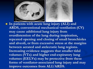 

In patients with acute lung injury (ALI) and
ARDS, conventional mechanical ventilation (CV)
may cause additional lung injury from
overdistention of the lung during inspiration,
repeated opening and closing of small bronchioles
and alveoli, or from excessive stress at the margins
between aerated and atelectatic lung regions.
Increasing evidence suggests that smaller tidal
volumes (VTs) and higher end-expiratory lung
volumes (EELVs) may be protective from these
forms of ventilator-associated lung injury and may
improve outcomes from ALI/ARDS.

 