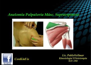 Anatomia palpatoria - musculo supraespinoso