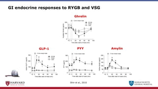 MASSACHUSETTS
GENERAL HOSPITAL
GI endocrine responses to RYGB and VSG
Time after start of meal (min)
0 20 40 60 80 100
Active
GLP-1
(pg/ml)
0
50
100
150
200
250
300
RYGB
Sham
Lean
5 min mixed meal
-10
*
#
*
*
*
GLP-1
Time after start of meal (min)
0 20 40 60 80 100
PYY
(pg/ml)
0
50
100
150
200
250
300
RYGB
Sham
Lean
5 min mixed meal
-10
*
*
*
*
*
*
*
Time after start of meal (min)
0 20 40 60 80 100
PYY
(pg/ml)
0
50
100
150
200
250
300
RYGB
Sham
Lean
5 min mixed meal
-10
*
*
*
*
*
*
*
PYY
Time after start of meal (min)
0 20 40 60 80 100
Active
Amylin
(pg/ml)
0
50
100
150
200
250
5 min mixed meal
-10
*
*
Amylin
Time after start of meal (min)
0 20 40 60 80 100
Acylated
Ghrelin
(pg/ml)
0
50
100
150
200
250
300 RYGB
Sham
Lean
5 min mixed meal
-10
*
*
Ghrelin
Shin et al., 2010
 
