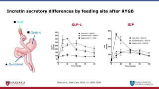 MASSACHUSETTS
GENERAL HOSPITAL
Incretin secretory differences by feeding site after RYGB
Oral
Gastric
Duodenal
GLP-1 GIP
Gero et al., Diab Care 2018; 41:1295-1298
 