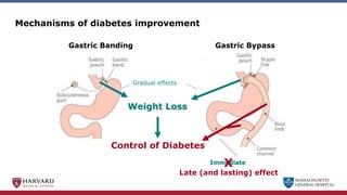 MASSACHUSETTS
GENERAL HOSPITAL
Control of Diabetes
Gastric Banding Gastric Bypass
Mechanisms of diabetes improvement
Gradual effects
Weight Loss
Immediate
Control of Diabetes
X
Late (and lasting) effect
 