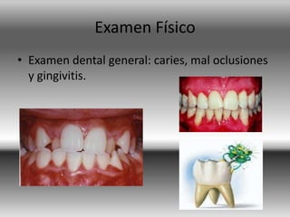 Examen Físico
• Examen dental general: caries, mal oclusiones
y gingivitis.
 