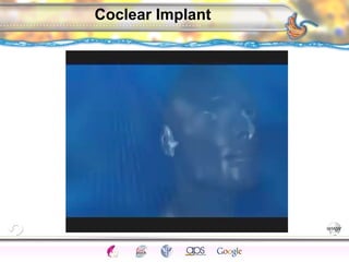 CNS Ignoring Light The Eye Seeing 
Taste/Smell 
Sound The Ear 
Touch/Pain Movement Perception Gestalt Depth cues 
Illusions 
Coclear Implant 
 