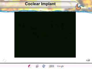 CNS Ignoring Light The Eye Seeing 
Taste/Smell 
Sound The Ear 
Touch/Pain Movement Perception Gestalt Depth cues 
Illusions 
Coclear Implant 
 