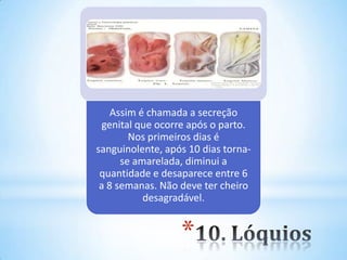 *
Assim é chamada a secreção
genital que ocorre após o parto.
Nos primeiros dias é
sanguinolente, após 10 dias torna-
se amarelada, diminui a
quantidade e desaparece entre 6
a 8 semanas. Não deve ter cheiro
desagradável.
 