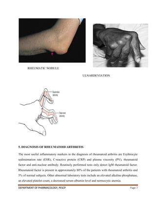 DEPARTMENT OF PHARMACOLOGY, PESCP Page 7
RHEUMATIC NODULE
ULNARDEVIATION
5. DIAGNOSIS OF RHEUMATOID ARTHRITIS
The most useful inflammatory markers in the diagnosis of rheumatoid arthritis are Erythrocyte
sedimentation rate (ESR), C-reactive protein (CRP) and plasma viscosity (PV), rheumatoid
factor and anti-nuclear antibody. Routinely performed tests only detect IgM rheumatoid factor.
Rheumatoid factor is present in approximately 80% of the patients with rheumatoid arthritis and
5% of normal subjects. Other abnormal laboratory tests include an elevated alkaline phosphatase,
an elevated platelet count, a decreased serum albumin level and normocytic anemia.
 