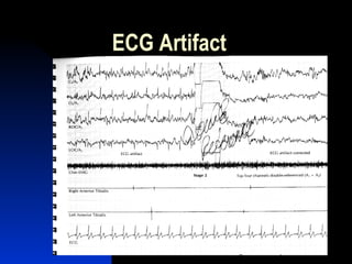 Apt artifact recognition & troubleshooting | PPT