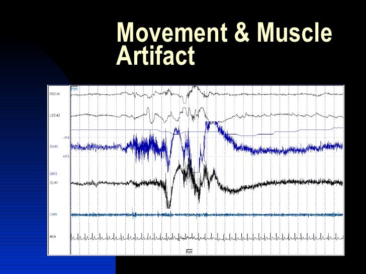 Apt artifact recognition & troubleshooting