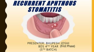RECURRENT APHTHOUS
STOMATITIS
PRESENTER: BHUPESH JOSHI
BDS 4TH YEAR
(5TH BATCH)
(First Phase)
 