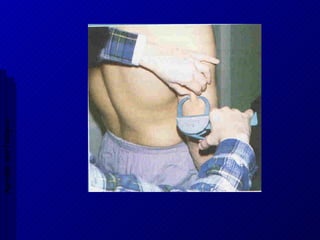 Aptidão morfológica 