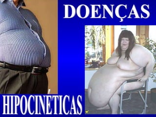 DOENÇAS HIPOCINÉTICAS 