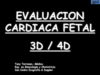 EVALUACION
CARDIACA FETAL
3D / 4D
Tony Terrones, Médico
Esp. en Ginecología y Obstetricia
San Isidro Ecografía & Doppler
 