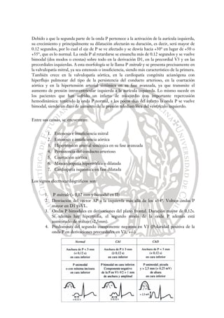 Debido a que la segunda parte de la onda P pertenece a la activación de la aurícula izquierda,
su crecimiento y principalmente su dilatación afectarán su duración, es decir, será mayor de
0.12 segundos, por lo cual el eje de P se ve afectado y se desvía hacia +30° en lugar de +50 o
+55°, que es lo normal. La onda P al retardarse se ensancha más de 0.12 segundos y se vuelve
bimodal (dos modos o crestas) sobre todo en la derivación D1, en la precordial V3 y en las
precordiales izquierdas. A esta morfología se le llama P mitrale y se presenta precisamente en
la valvulopatía mitral, ya sea estenosis o insuficiencia, siendo más característico de la primera.
También crece en la valvulopatía aórtica, en la cardiopatía congénita acianógena con
hiperflujo pulmonar del tipo de la persistencia del conducto arterioso, en la coartación
aórtica y en la hipertensión arterial sistémica en su fase avanzada, ya que transmite el
aumento de presión intraventricular izquierda a la aurícula izquierda. Lo mismo sucede en
los pacientes que han sufrido un infarto de miocardio con importante repercusión
hemodinámica: teniendo la onda P normal, a los pocos días del infarto la onda P se vuelve
bimodal, siendo un dato de aumento de la presión telediastólica del ventrículo izquierdo.
Entre sus causas, se encuentran:
1. Estenosis e insuficiencia mitral
2. Estenosis e insuficiencia aórtica
3. Hipertensión arterial sistémica en su fase avanzada
4. Persistencia del conducto arterioso
5. Coartación aórtica
6. Miocardiopatía hipertrófica o dilatada
7. Cardiopatía isquémica en fase dilatada
Los signos electrocardiográficos son:
1. P mitrale (> 0,12 mm y bimodal en II)
2. Desviación del vector AP a la izquierda más allá de los +54°. Voltaje ondas P
mayor en D1 yaVL.
3. Ondas P bimodales en derivaciones del plano frontal. Duración mayor de 0,12s.
Si además hay hipertrofia, el segundo modo de la onda P además está
aumentado de voltaje(>2,5mm).
4. Predominio del segundo componente negativo en V1 (Polaridad positiva de la
onda P en derivaciones precordiales en V1, +--).
 