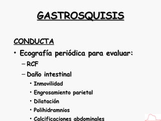 GASTROSQUISIS CONDUCTA Ecografía periódica para evaluar: RCF Daño intestinal Inmovilidad Engrosamiento parietal Dilatación Polihidramnios Calcificaciones abdominales 