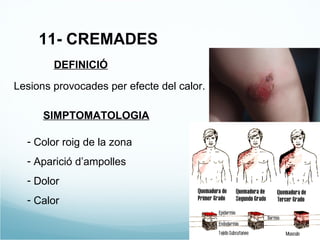 11- CREMADES DEFINICIÓ Lesions provocades per efecte del calor. SIMPTOMATOLOGIA Color roig de la zona Aparició d’ampolles Dolor Calor 