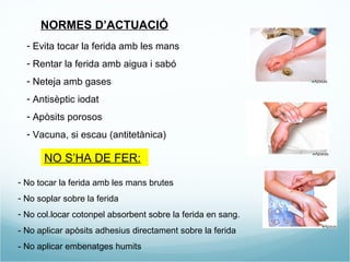 NORMES D’ACTUACIÓ Evita tocar la ferida amb les mans  Rentar la ferida amb aigua i sabó  Neteja amb gases Antisèptic iodat Apòsits porosos  Vacuna, si escau (antitetànica) NO S’HA DE FER: No tocar la ferida amb les mans brutes No soplar sobre la ferida No col.locar cotonpel absorbent sobre la ferida en sang. - No aplicar apòsits adhesius directament sobre la ferida - No aplicar embenatges humits 