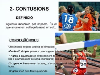 2- CONTUSIONS  DEFINICIÓ Agressió mecànica per impacte. És el que anomenem col.loquilament, un colp. CONSEQÜÈNCIES Classificació segons la força de l’impacte: Contusió simple:  provoca un enrogiment de la pell. Per ex. una bofetada. 1r grau o equimosi:  és el trencament de xicotets vasos sanguinis que donen lloc a acumulacions de sang (moradures) que se situen en la dermis. 2n grau o hematoma:  la sang, s’acumula en el teixit cel.lular subcutani, bony. 3r   grau : mort dels teixits profunds. 
