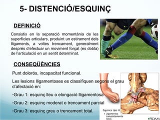 5- DISTENCIÓ/ESQUINÇ DEFINICIÓ Consistix en la separació momentània de les superfícies articulars, produint un estirament dels lligaments, a voltes trencament, generalment després d’efectuar un moviment forçat (es dobla) de l’articulació en un sentit determinat. CONSEQÜÈNCIES Punt dolorós, incapacitat funcional. Les lesions lligamentoses es classifiquen segons el grau d’afectació en: Grau 1: esquinç lleu o elongació lligamentosa Grau 2: esquinç moderat o trencament parcial Grau 3: esquinç greu o trencament total. 
