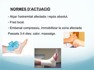 NORMES D’ACTUACIÓ - Alçar l’extremitat afectada i repòs absolut.  Fred local.  Embenat compressiu, immobilitzar la zona afectada. Passats 3-4 dies: calor, massatge. 