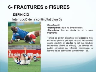 6- FRACTURES o FISURES DEFINICIÓ Interrupció de la continuïtat d’un ós Classificació: Incompletes : no hi ha divisió de l’ós Completes : l’ós es dividix en un o més fragments. També es poden classificar en  tancades  (l’ós es trenca però la pell que recubrix l’extremitat queda intacta) i en  obertes  (la pell que recubrix l’extremitat també es trenca). Les obertes es poden complicar per infecció, hemorràgia, o lesions de les estructures que envolten l’ós. 