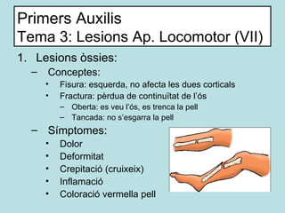 Primers Auxilis Tema 3: Lesions Ap. Locomotor (VII) <ul><li>Lesions òssies: </li></ul><ul><ul><li>Conceptes: </li></ul></u...