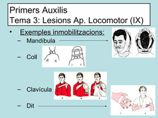 Primers Auxilis Tema 3: Lesions Ap. Locomotor (IX) <ul><li>Exemples inmobilitzacions: </li></ul><ul><ul><li>Mandíbula </li...