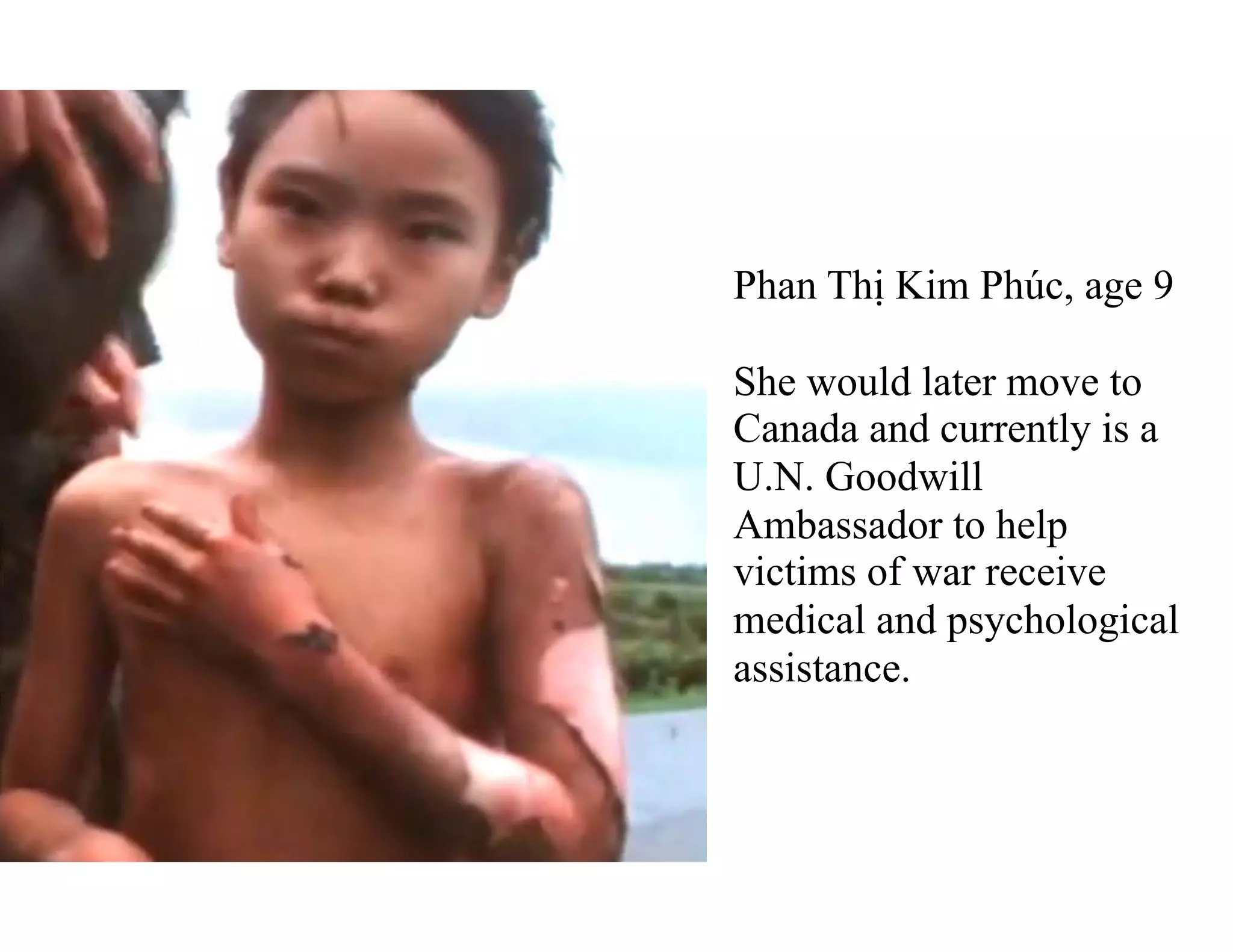 Phan Thị Kim Phúc, age 9
She would later move to
Canada and currently is a
U.N. Goodwill
Ambassador to help
victims of war receive
medical and psychological
assistance.
 