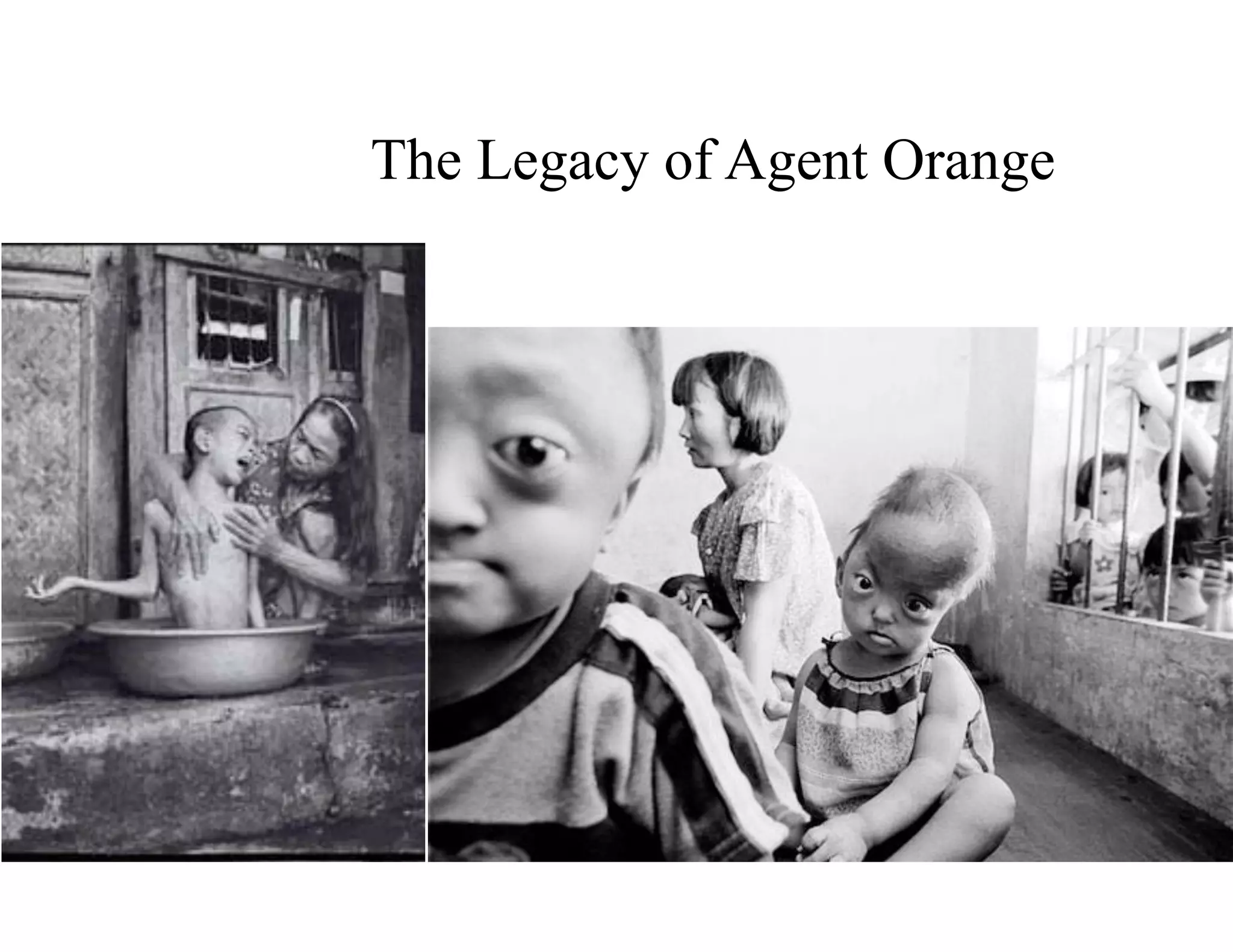 The Legacy of Agent Orange
 