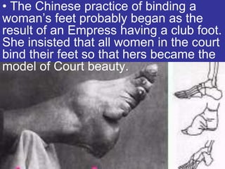 • The Chinese practice of binding a
woman’s feet probably began as the
result of an Empress having a club foot.
She insisted that all women in the court
bind their feet so that hers became the
model of Court beauty.
 