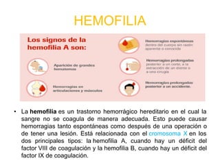 HEMOFILIA
• La hemofilia es un trastorno hemorrágico hereditario en el cual la
sangre no se coagula de manera adecuada. Esto puede causar
hemorragias tanto espontáneas como después de una operación o
de tener una lesión. Está relacionada con el cromosoma X en los
dos principales tipos: la hemofilia A, cuando hay un déficit del
factor VIII de coagulación y la hemofilia B, cuando hay un déficit del
factor IX de coagulación.
 