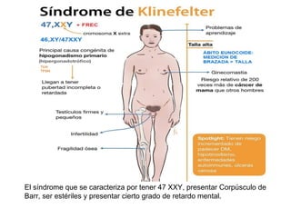 Síndrome de klinefelter
El síndrome que se caracteriza por tener 47 XXY, presentar Corpúsculo de
Barr, ser estériles y presentar cierto grado de retardo mental.
 