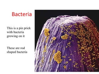 Bacteria

This is a pin prick
with bacteria
growing on it


These are rod
shaped bacteria
 