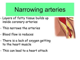 Narrowing arteries
• Layers of fatty tissue builds up
inside coronary arteries
• This narrows the arteries
• Blood flow is reduces
• There is a lack of oxygen getting
to the heart muscle
• This can lead to a heart attack
 