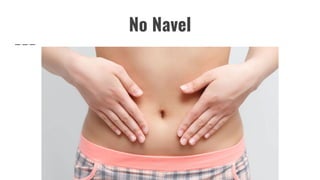 No Navel
 